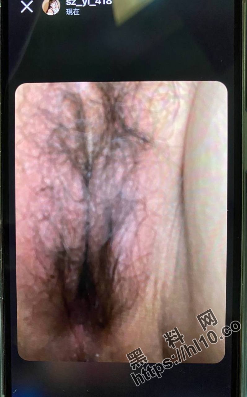 797X1278